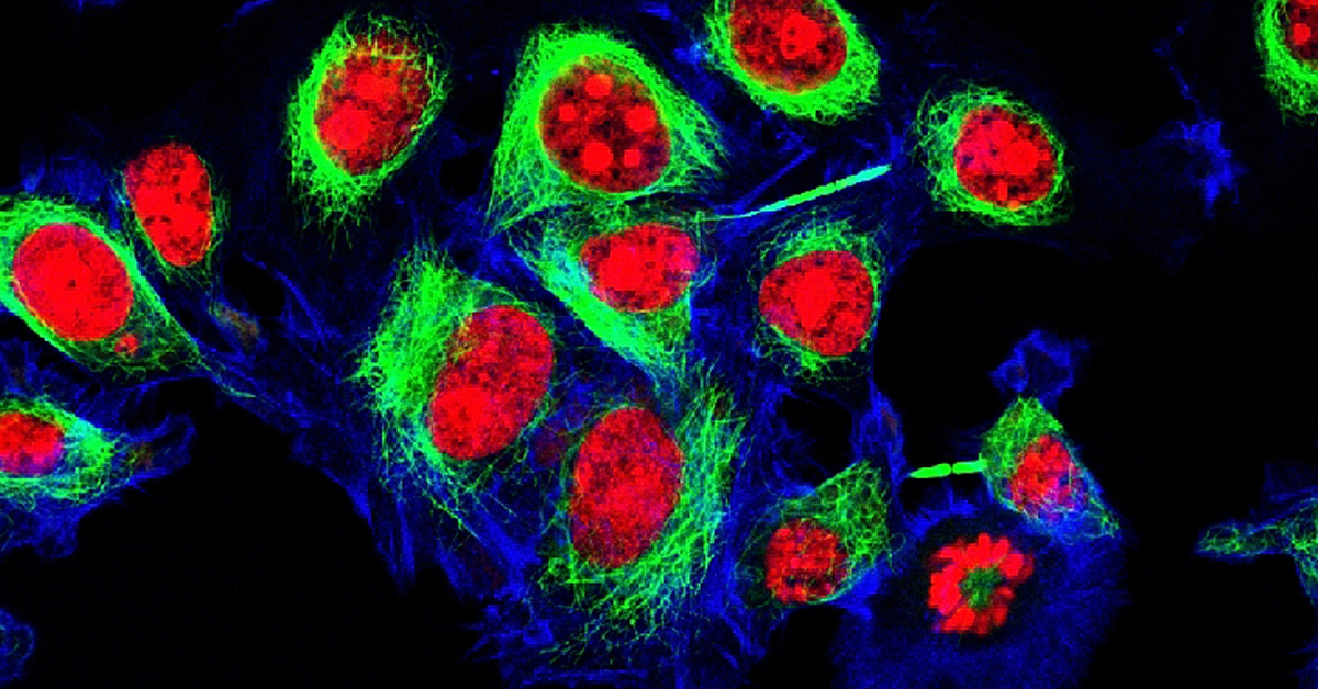 Leveraging AI in Cell Culture Analysis